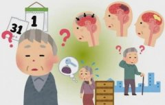 阿尔茨海默病治疗方法全指南:从早筛到长期管理,关键在“早”